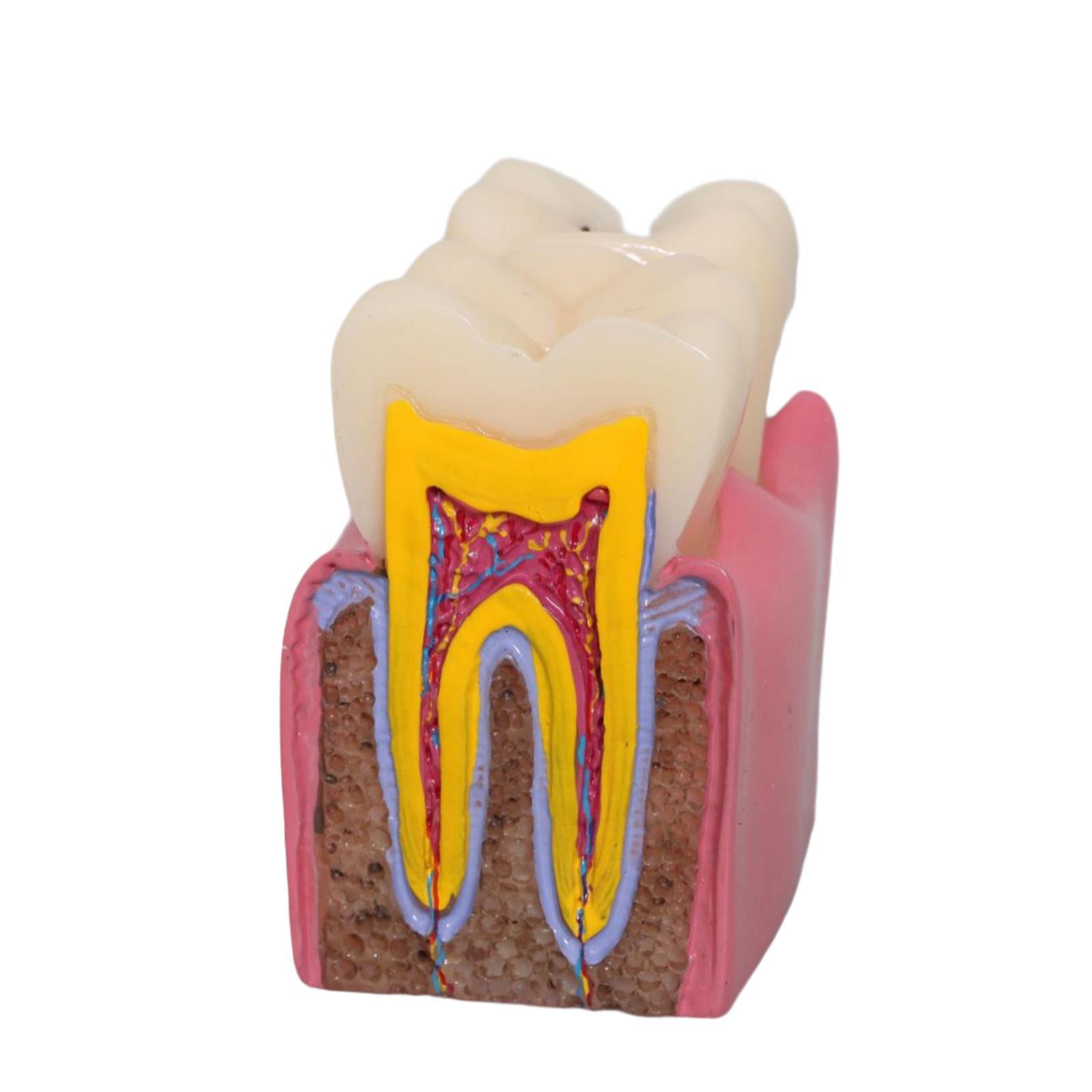 Tooth Decay Model Roots Canal  - Kids Education Classes 评论和价格